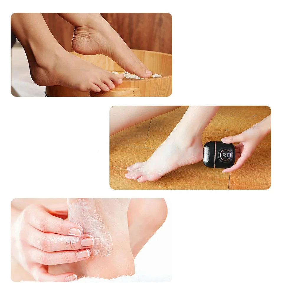 Electric Feet Sander Machine Rupture Skin Trimmer Dead Skin for Heels Foot Care Grinding Pedicure Tools Recharge Remover Callus