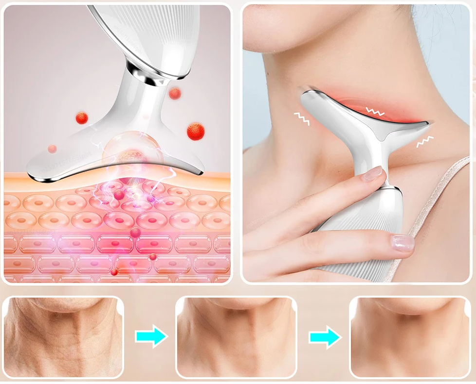 Appareil de Lifting Thermique pour le visage et le cou